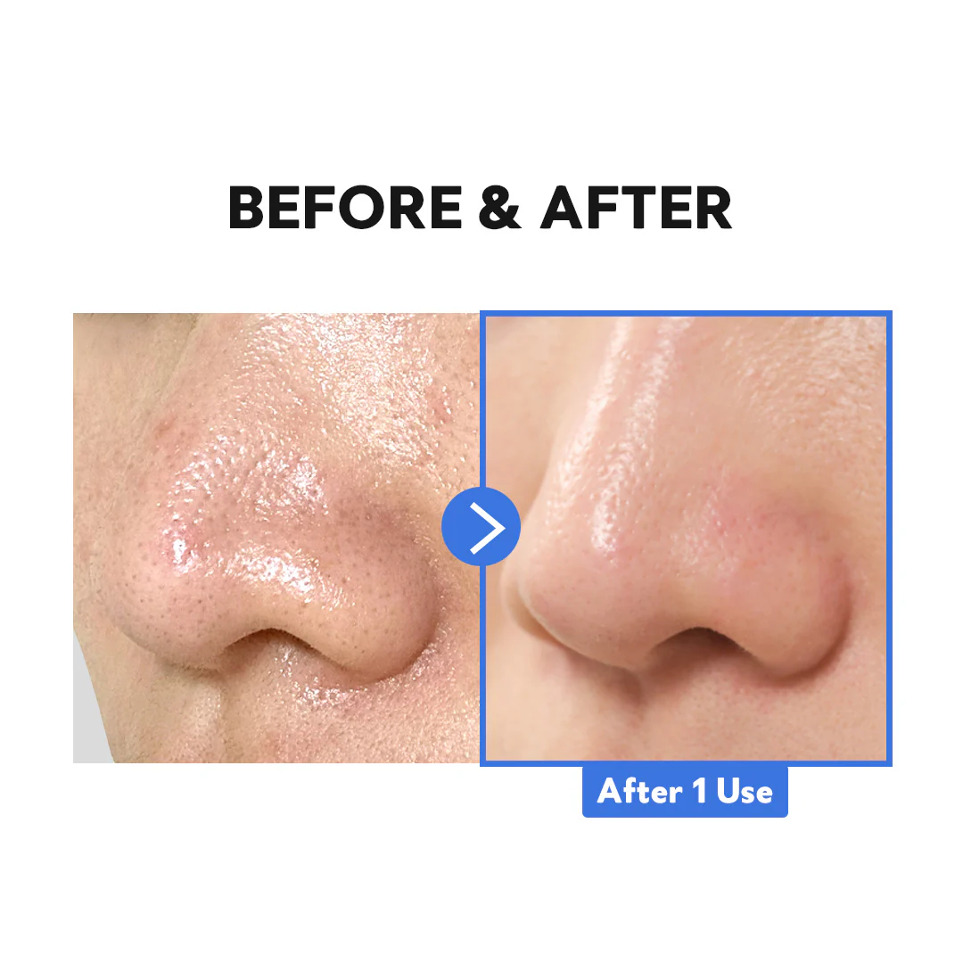 TIRTIR - Hydro Boost Enzyme Cleansing Balm - Image 7